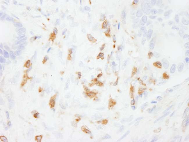 Coronin 1 Antibody in Immunohistochemistry (Paraffin) (IHC (P))