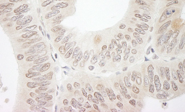 DTL/CDT2 Antibody in Immunohistochemistry (Paraffin) (IHC (P))