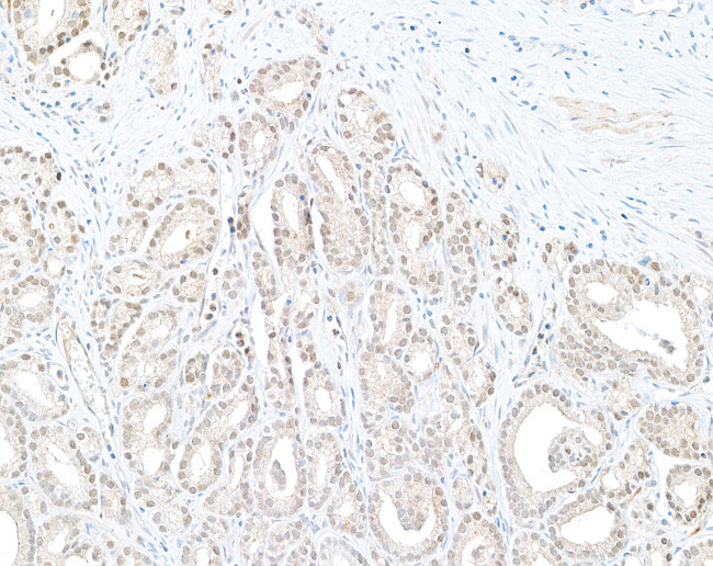 DTL/CDT2 Antibody in Immunohistochemistry (Paraffin) (IHC (P))
