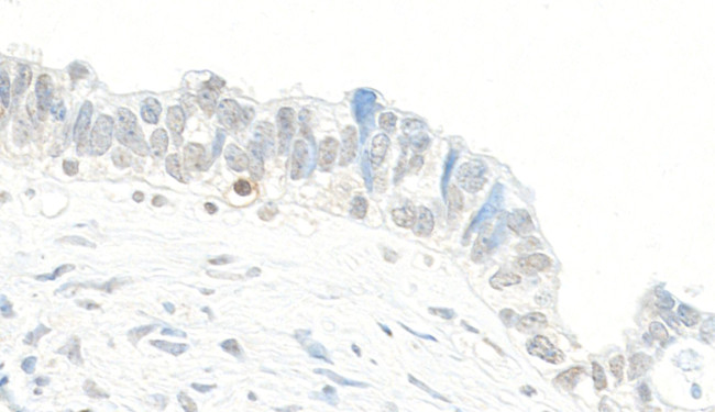 Topo II Beta Antibody in Immunohistochemistry (Paraffin) (IHC (P))