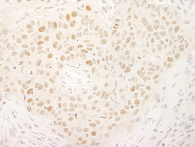 KIFC1 Antibody in Immunohistochemistry (Paraffin) (IHC (P))
