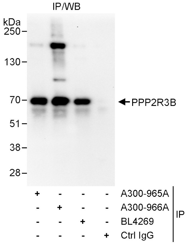 PPP2R3B Antibody in Immunoprecipitation (IP)