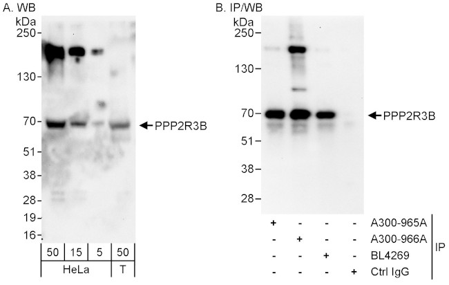 PPP2R3B Antibody in Western Blot (WB)