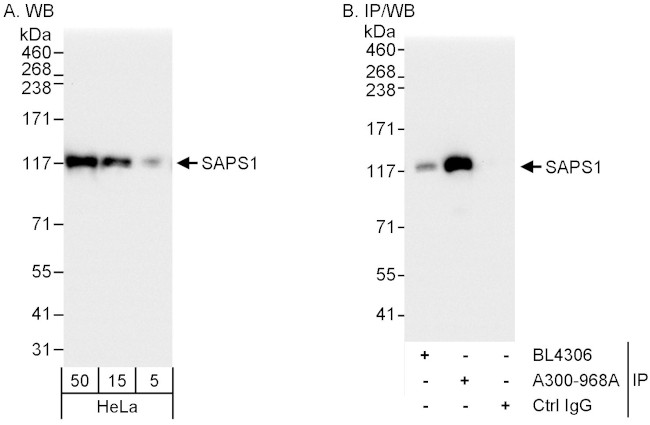 SAPS1 Antibody in Western Blot (WB)