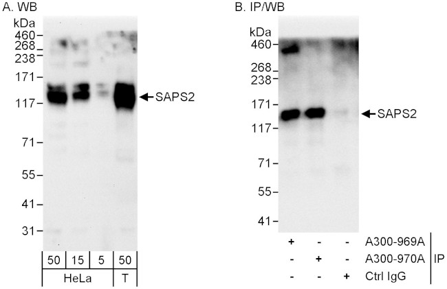 SAPS2 Antibody in Western Blot (WB)