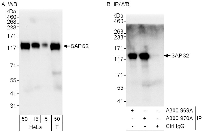 SAPS2 Antibody in Western Blot (WB)
