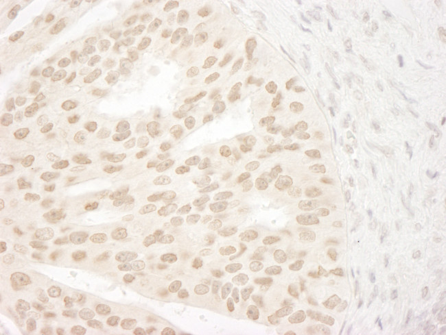 ANKRD28/PITK Antibody in Immunohistochemistry (Paraffin) (IHC (P))