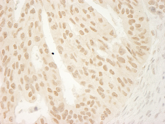 CTNND1 Antibody in Immunohistochemistry (Paraffin) (IHC (P))