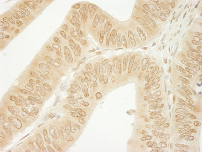 CTNND1 Antibody in Immunohistochemistry (Paraffin) (IHC (P))