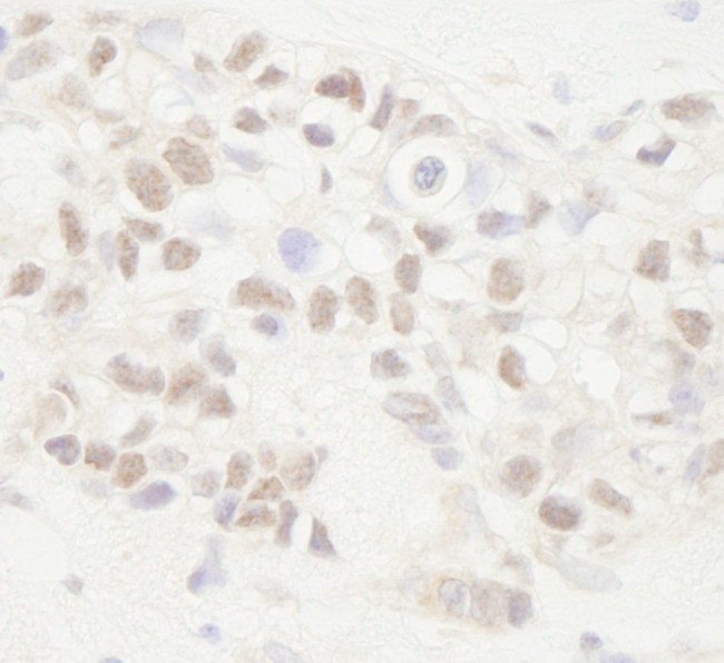 APC Antibody in Immunohistochemistry (Paraffin) (IHC (P))
