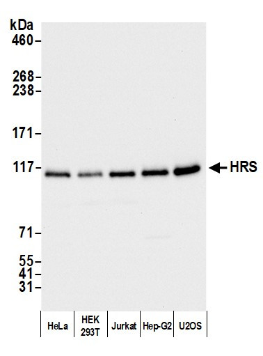 HRS Antibody in Western Blot (WB)