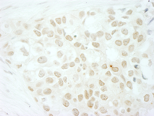 MKRN2 Antibody in Immunohistochemistry (Paraffin) (IHC (P))