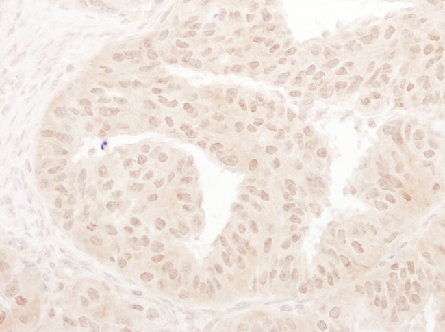 MOF/MYST1 Antibody in Immunohistochemistry (Paraffin) (IHC (P))