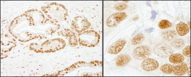 SF3b155/SAP155 Antibody in Immunohistochemistry (Paraffin) (IHC (P))