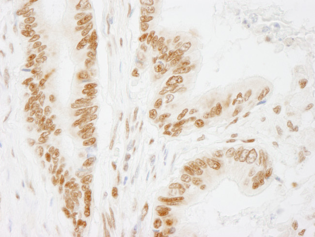 ACINUS/ACN1 Antibody in Immunohistochemistry (Paraffin) (IHC (P))