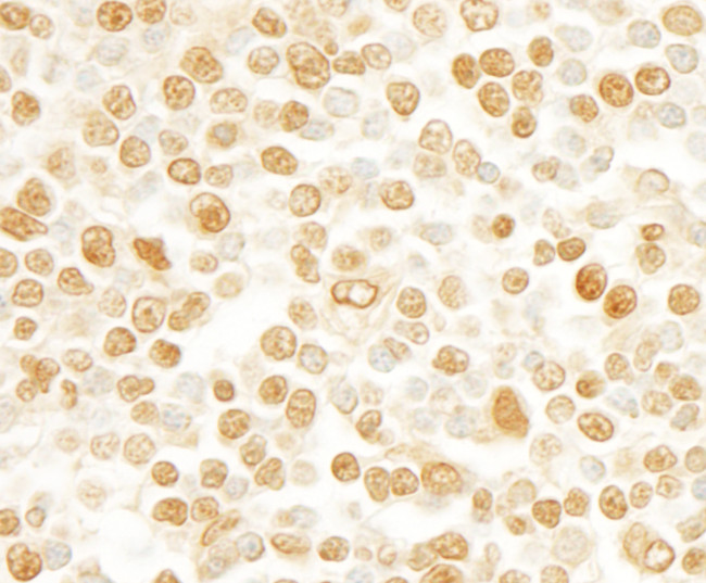 SFRS2IP Antibody in Immunohistochemistry (Paraffin) (IHC (P))