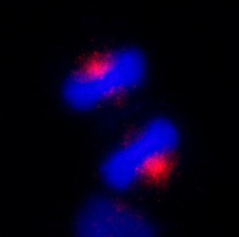CEP170 Antibody in Immunocytochemistry (ICC/IF)