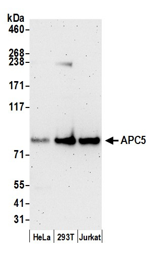 APC5 Antibody in Western Blot (WB)