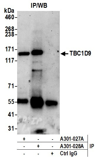 TBC1D9 Antibody in Immunoprecipitation (IP)
