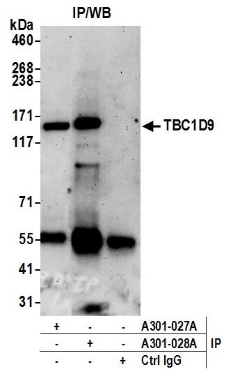 TBC1D9 Antibody in Immunoprecipitation (IP)