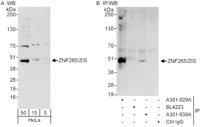 ZNF265/ZIS Antibody in Western Blot (WB)