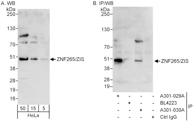 ZNF265/ZIS Antibody in Western Blot (WB)