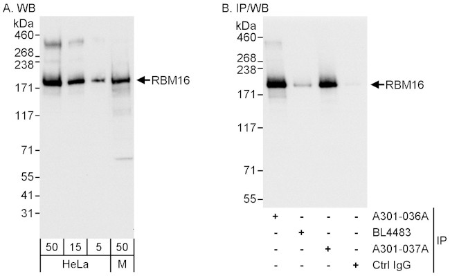 RBM16 Antibody in Western Blot (WB)