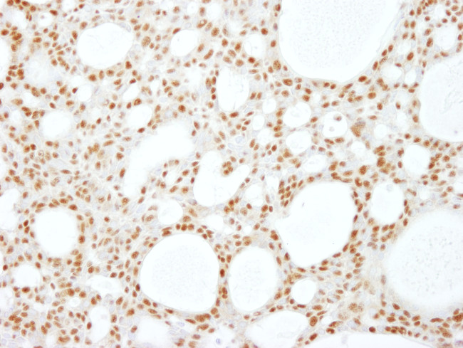 RBM16 Antibody in Immunohistochemistry (Paraffin) (IHC (P))