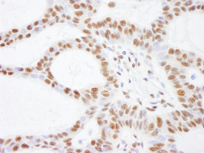SMARCC2/BAF170 Antibody in Immunohistochemistry (Paraffin) (IHC (P))
