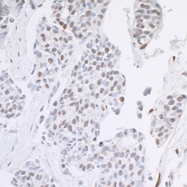 ARID1B Antibody in Immunohistochemistry (Paraffin) (IHC (P))