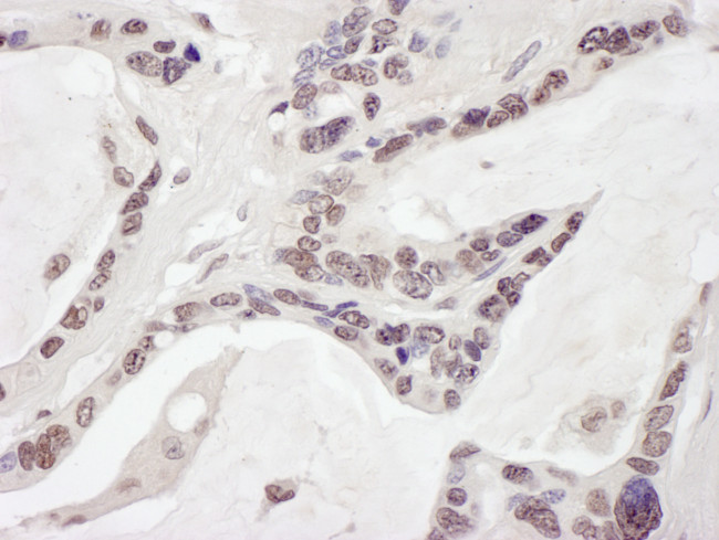 ARID1B Antibody in Immunohistochemistry (Paraffin) (IHC (P))