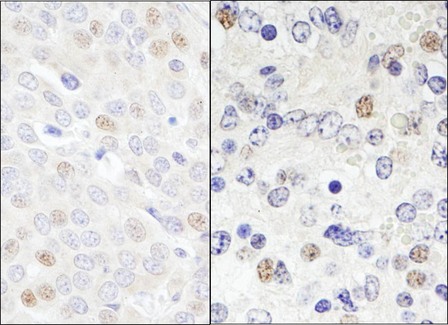 DDX46 Antibody in Immunohistochemistry (Paraffin) (IHC (P))