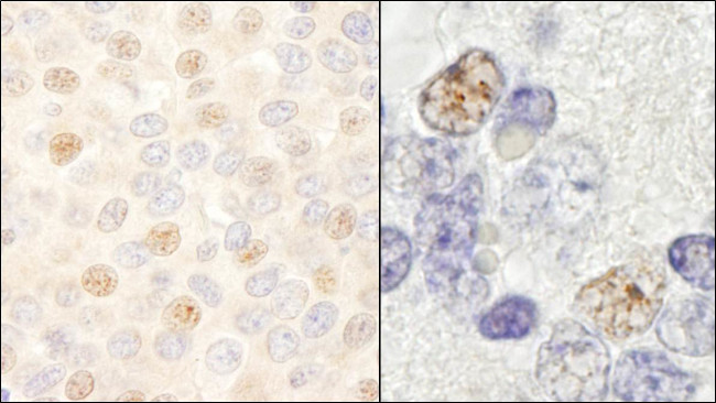 DDX46 Antibody in Immunohistochemistry (Paraffin) (IHC (P))