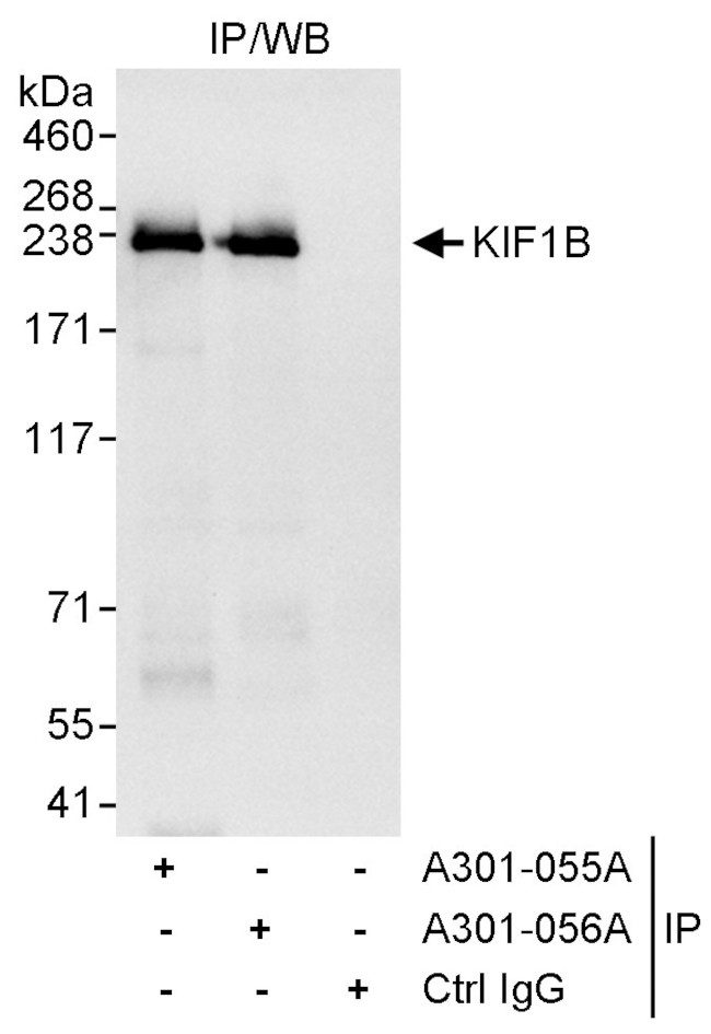 KIF1B Antibody in Immunoprecipitation (IP)