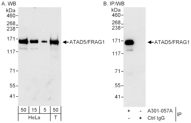 ATAD5/FRAG1 Antibody in Western Blot (WB)