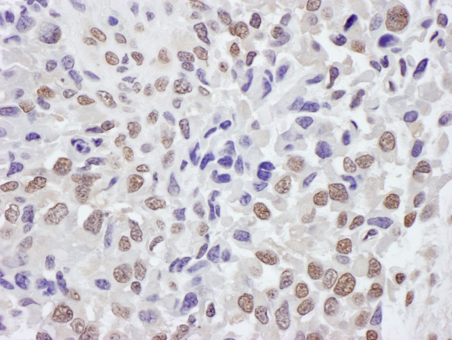 TRIM33/TIF1gamma Antibody in Immunohistochemistry (Paraffin) (IHC (P))