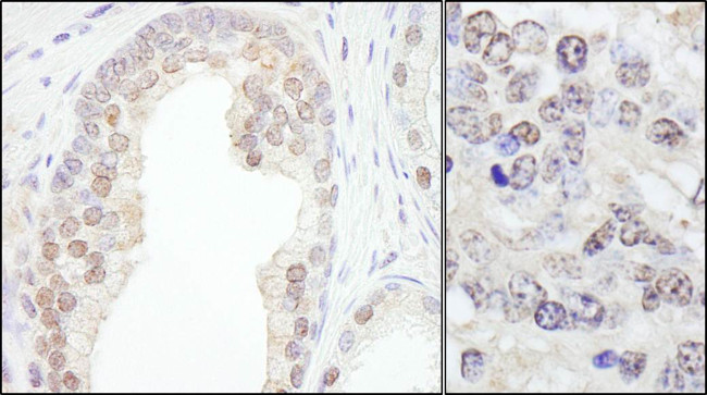 TRIM33/TIF1gamma Antibody in Immunohistochemistry (Paraffin) (IHC (P))