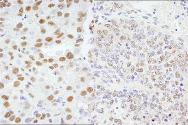 AKAP8/AKAP95 Antibody in Immunohistochemistry (Paraffin) (IHC (P))