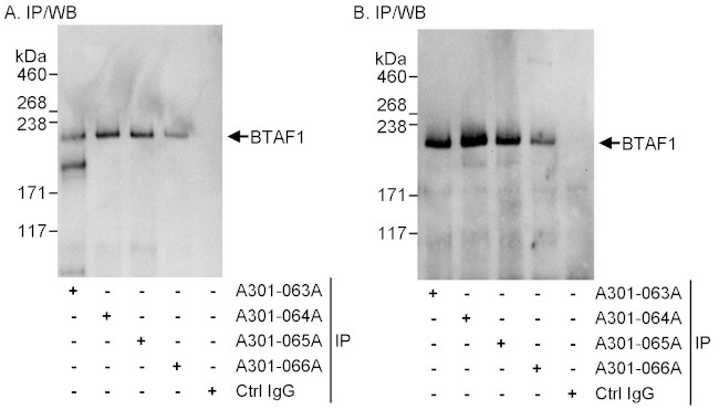 BTAF1 Antibody in Immunoprecipitation (IP)