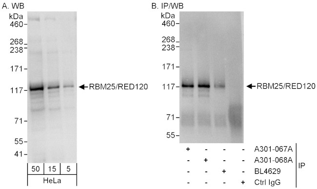 RBM25/RED120 Antibody in Western Blot (WB)