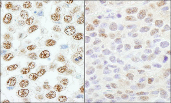 RBM25/RED120 Antibody in Immunohistochemistry (Paraffin) (IHC (P))