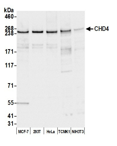 CHD4 Antibody in Western Blot (WB)