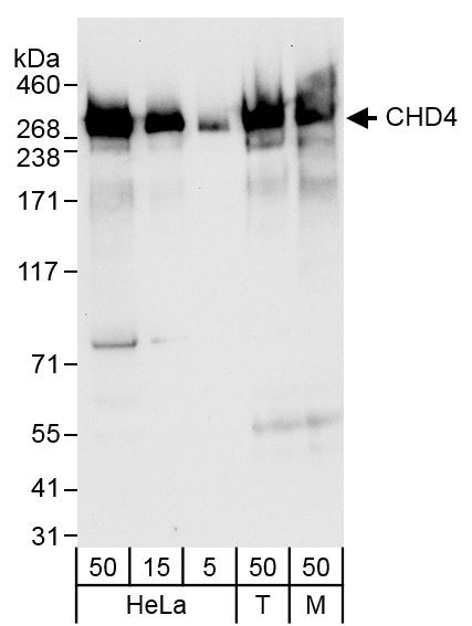 CHD4 Antibody in Western Blot (WB)