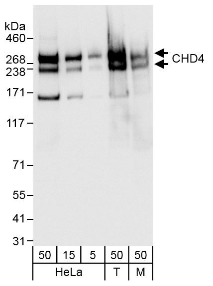 CHD4 Antibody in Western Blot (WB)