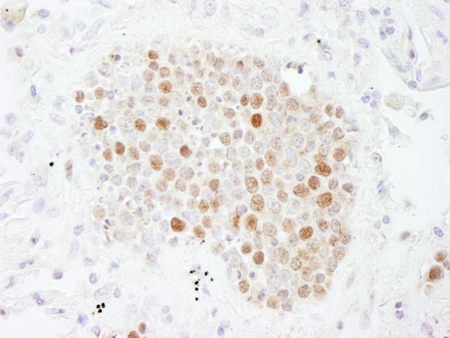 CAF-1 p60 Antibody in Immunohistochemistry (Paraffin) (IHC (P))