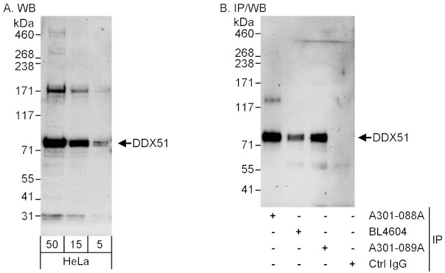 DDX51 Antibody in Western Blot (WB)