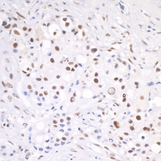 CSTF64 Antibody in Immunohistochemistry (Paraffin) (IHC (P))