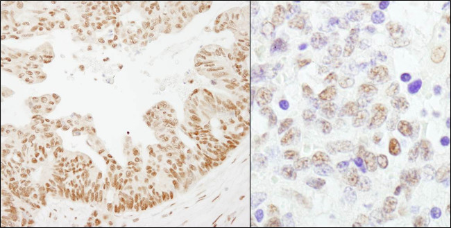 CSTF64 Antibody in Immunohistochemistry (Paraffin) (IHC (P))