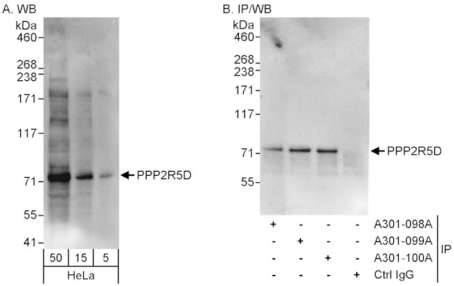 PPP2R5D Antibody in Western Blot (WB)