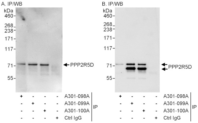 PPP2R5D Antibody in Immunoprecipitation (IP)